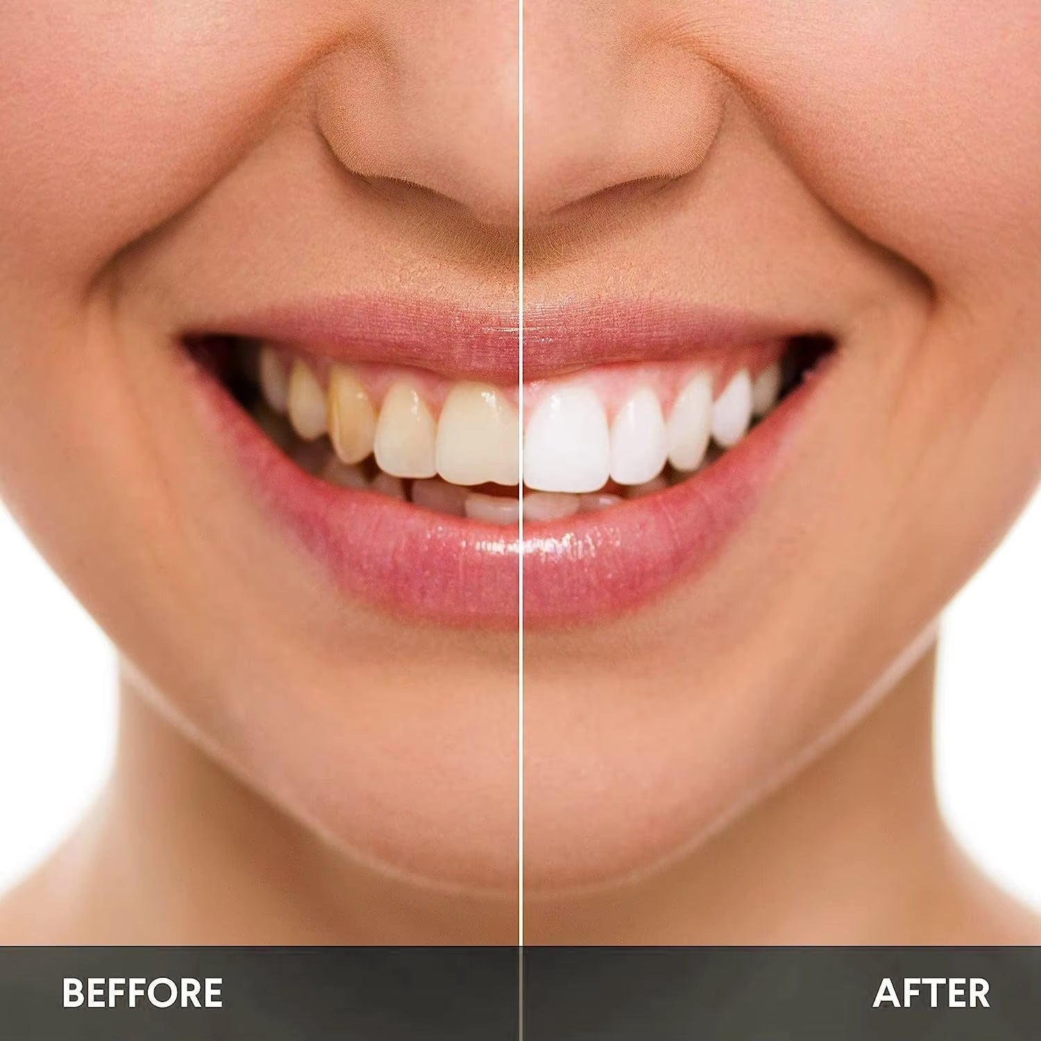 OEM Premium at Home 10 Min Timer Cold Blue Led Light Laser Teeth Whitening Kit Wholesale